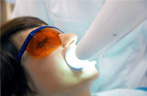 Understanding the Causes of Teeth Sensitivity Rochdale
