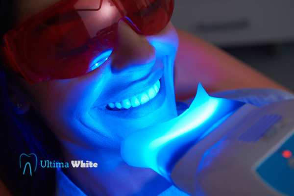 Professional Teeth Whitening Options Rochdale