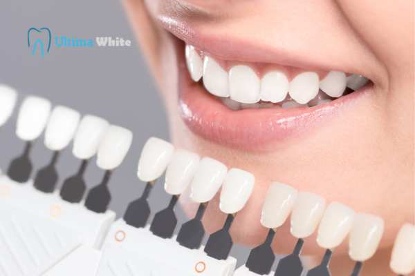 How to Maximise the Results of Your Laser Teeth Whitening Treatment Rochdale