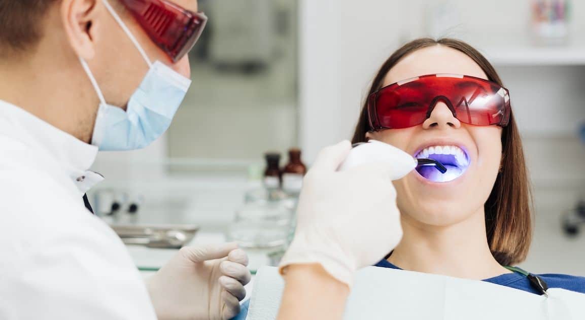 Do Dental Crowns Change Colour After Teeth Whitening Rochdale?