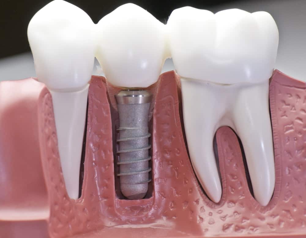 Common Misconceptions About Modern Dental Treatments Rochdale