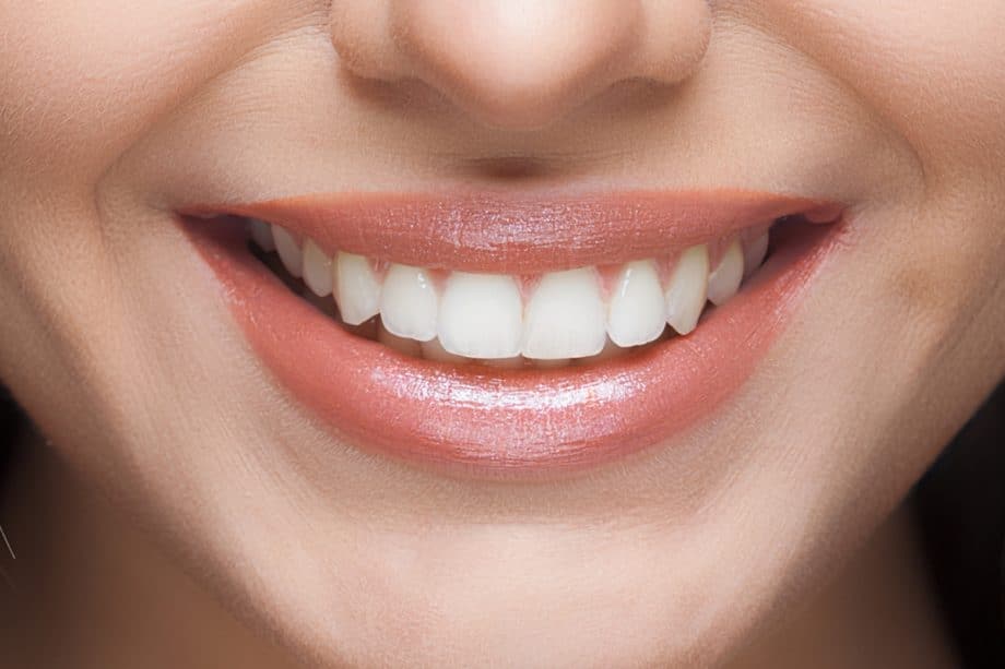 The Impact of White Spots on Oral Health Rochdale