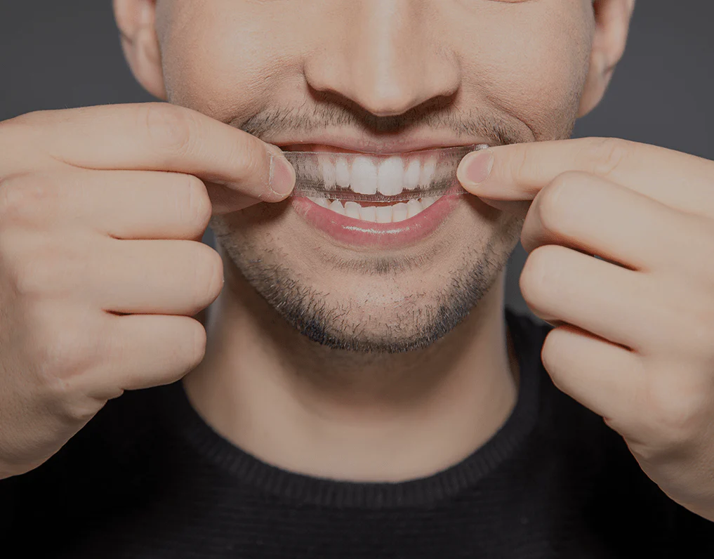 What to Consider Before Choosing a Teeth Whitening Option Rochdale