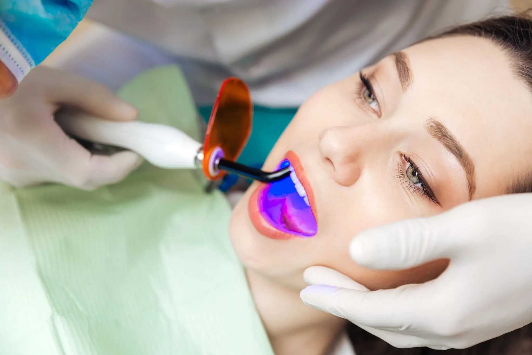 How Long Can You Expect Laser Teeth Whitening Results to Last Rochdale?