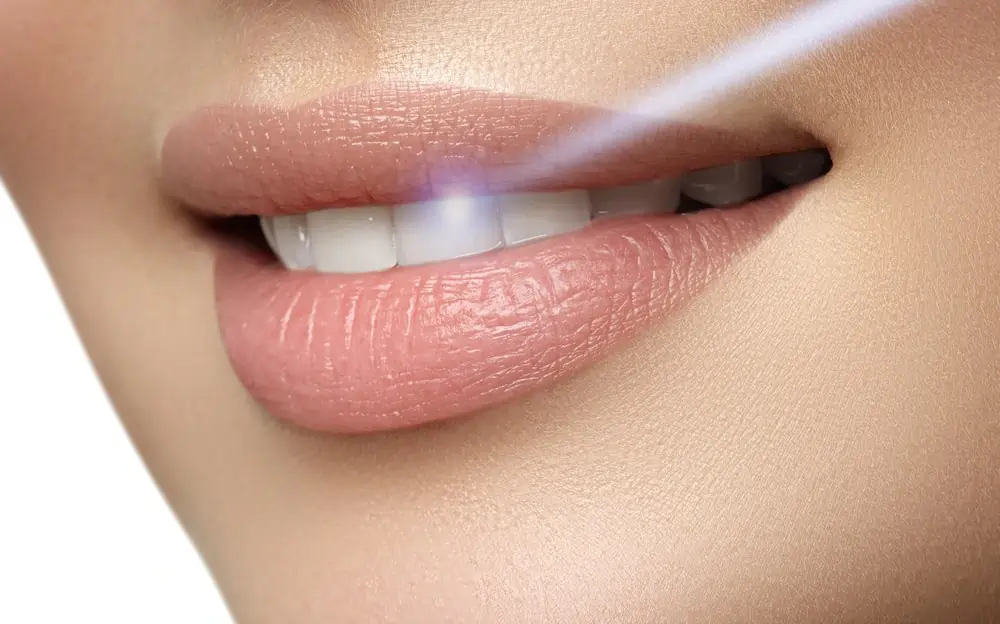 Understanding Teeth Whitening Risks and Results Rochdale