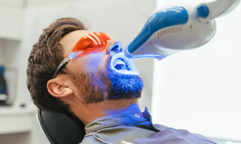 The Hidden Differences Between DIY and Professional Teeth Whitening Rochdale