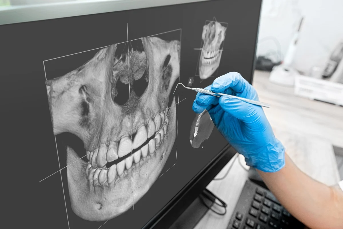 Key Benefits of 3D Printing for Patients and Dentists Rochdale