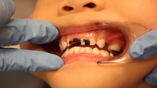 Can Your Diet Help You Achieve a Whiter, Healthier Smile Rochdale?