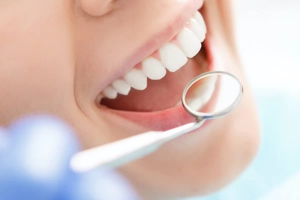 Preventing White Spots on Teeth Rochdale