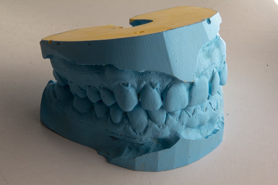 How Do Dental Implants Improve Jawbone Health and Oral Function Rochdale?