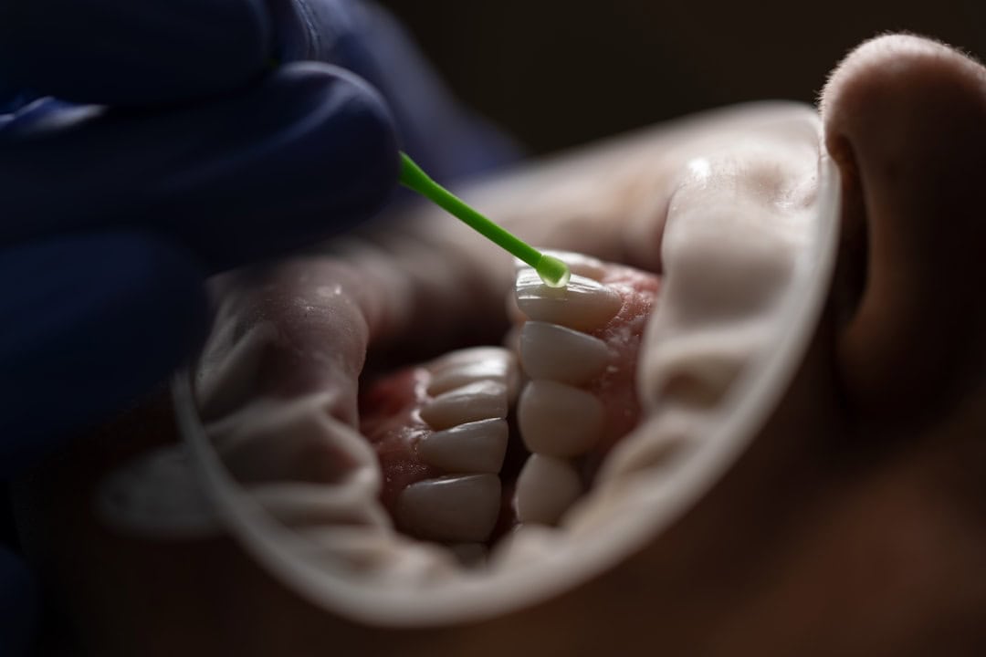 The Role of Saliva: Nature’s Defense System Rochdale