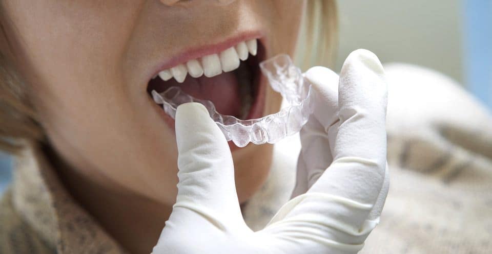 Can Bruxism Affect Your Sleep Quality Rochdale