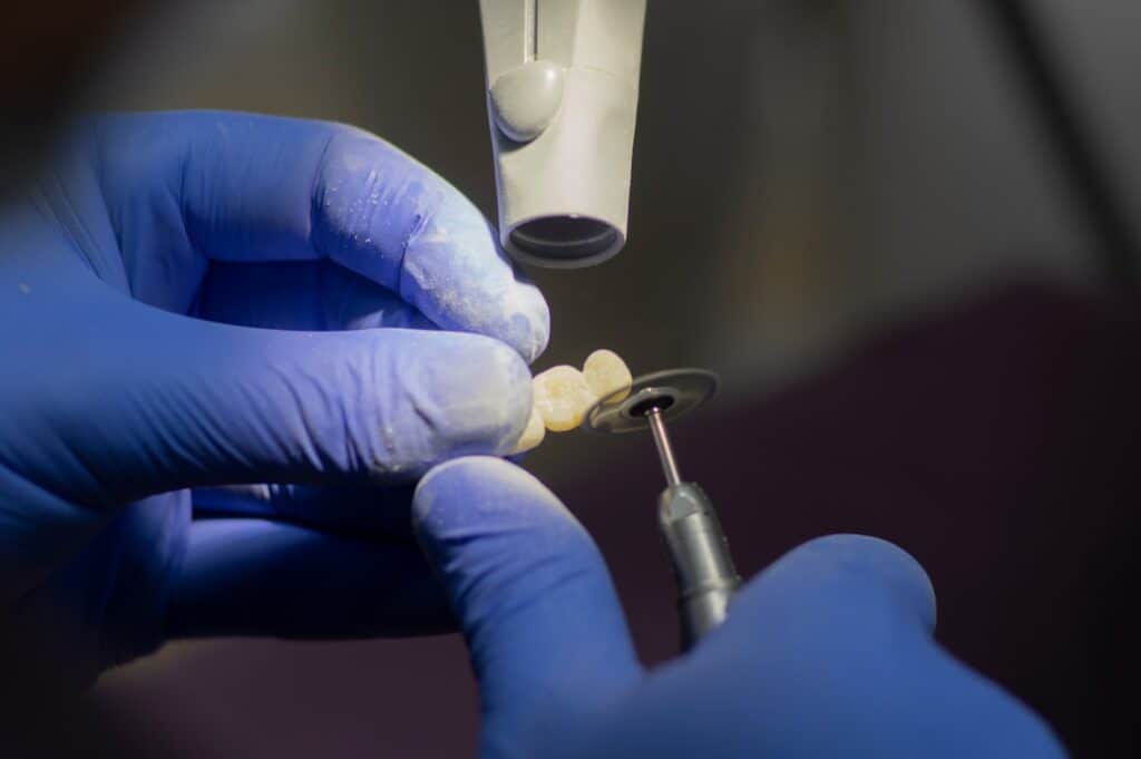 Customised Dental Solutions: Crowns, Aligners, and Implants Rochdale
